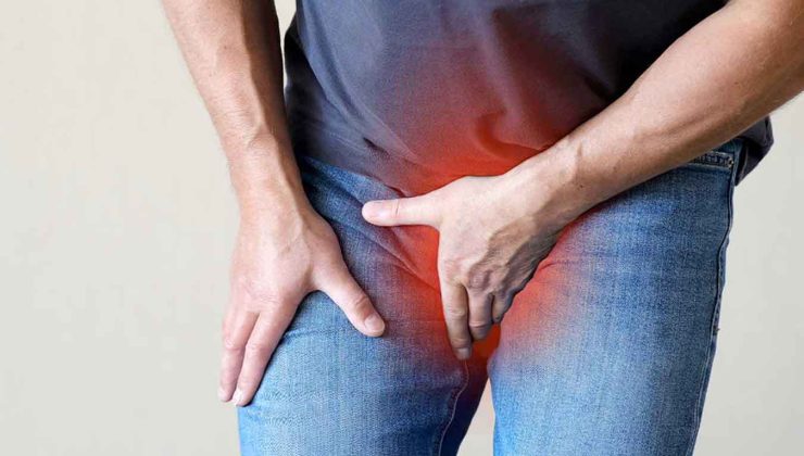 Varikosel: Tanı, Tedavi ve 30 Yıllık Deneyim